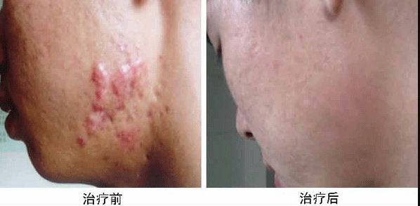 合肥哪家整容醫(yī)院雙眼皮做得好？專業(yè)整形外科專家推薦