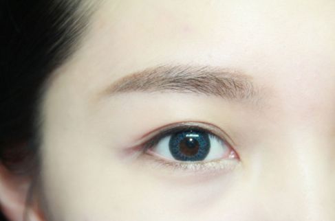 寧波哪家醫(yī)院割雙眼皮效果好？