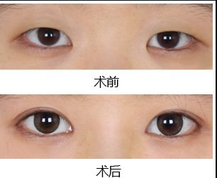 鄭州去黑點(diǎn)哪家醫(yī)院好？揭秘最受歡迎的黑點(diǎn)去除醫(yī)院