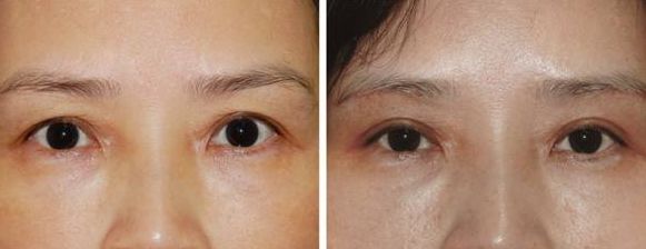 上海激光美容醫(yī)院排名及熱門選擇，哪家好？