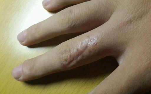 上海哪家醫(yī)院做肋骨鼻子整形手術(shù)好？