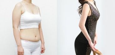 成都做雙眼皮，哪家醫(yī)院專業(yè)可靠？