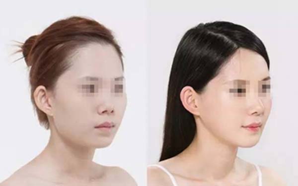 北京隆胸醫(yī)生排行：網(wǎng)友推薦的實力派、口碑出眾的美容專家值得關(guān)注