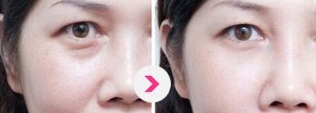 北京哪位醫(yī)生擅長(zhǎng)巨乳縮小手術(shù)？5名實(shí)力醫(yī)生值得推薦