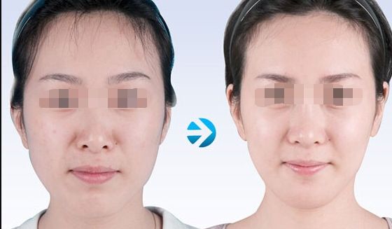 蘇州哪家吸脂好又實惠？專業(yè)美容機(jī)構(gòu)為您推薦