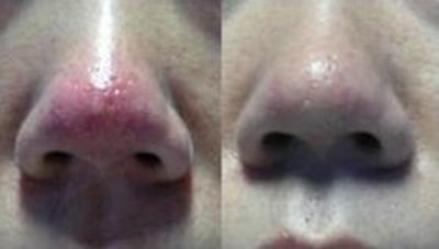 福州哪家醫(yī)生做隆胸技術(shù)好？推薦五位專業(yè)醫(yī)師，價(jià)格參考！