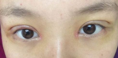 徐州做拉皮哪家醫(yī)院好？一起來看看徐州市最受歡迎的做拉皮醫(yī)院