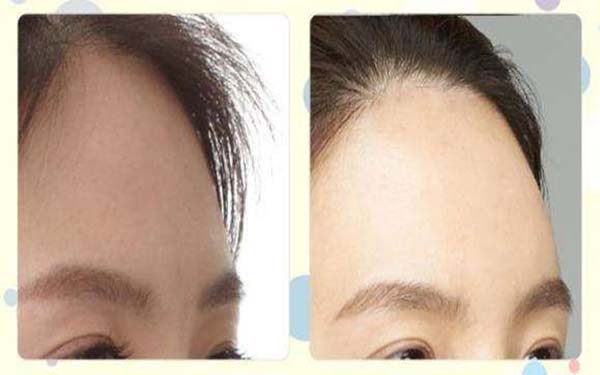 全國整容醫(yī)生PHD公開名單，創(chuàng)新技術(shù)行業(yè)新標(biāo)桿