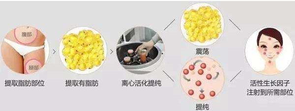 哈爾濱哪家醫(yī)院的去皺針效果好？