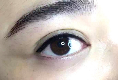 全國優(yōu)質(zhì)隆胸醫(yī)生盤點(diǎn)！孫好杰、姚然等實(shí)力強(qiáng)大，用戶口碑高漲！