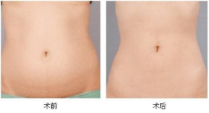 2023湘潭彩光美白嫩膚專家前10位排行榜(劉佑文、熊宜文、熊志能幫你圓夢)