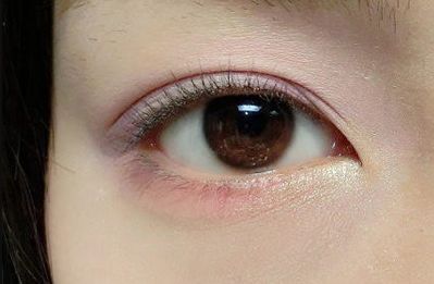 王世虎拉皮和脂肪填充的效果如何？有哪些多樣化的項(xiàng)目值得選擇？技術(shù)是否可靠可證？