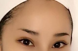 上海醫(yī)院最好治療皮膚疤痕的專(zhuān)科是哪家？