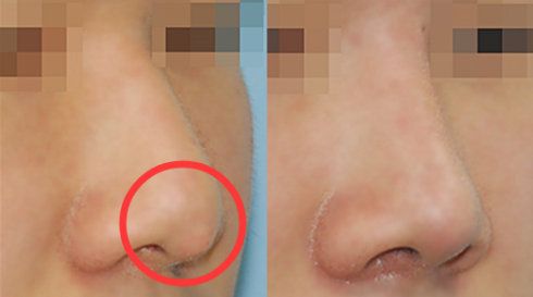 福州哪家醫(yī)院做疤痕好？比較全面的福州疤痕治療醫(yī)院推薦給您！