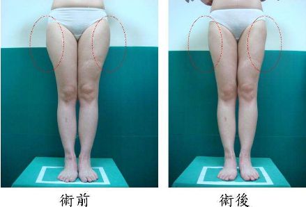昆明哪家治痘痘好的醫(yī)院，痘痘問題如何有效解決？