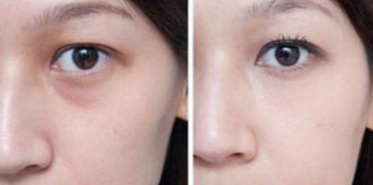 武漢看胎記醫(yī)院哪家好？綜合醫(yī)療機構(gòu)排行榜詳細解讀