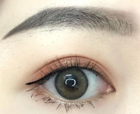 成都哪家美容醫(yī)院的埋線減肥效果好？