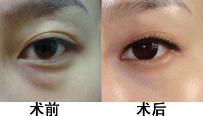 劉國權主刀，解讀成都醫(yī)美整形醫(yī)院的口碑與服務質量