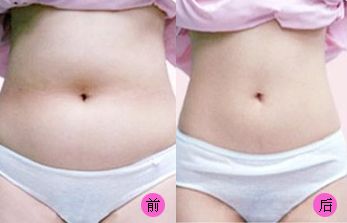 【2023吉林雙眼皮手術(shù)評(píng)測(cè)】哪家醫(yī)院值得信賴？