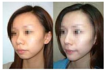 秦皇島美容美體哪家好？刷爆朋友圈的秘密美容院大揭秘！