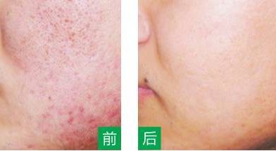 永州美辰醫(yī)療整形醫(yī)院的價格如何？收費(fèi)標(biāo)準(zhǔn)透明公開，術(shù)前注意事項(xiàng)必看！