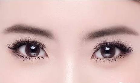 宋保強雙眼皮修復(fù)醫(yī)生評價及成功案例分享