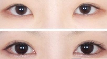 海口做隆鼻醫(yī)院哪家好？?？谀募艺葆t(yī)院的鼻部整形效果好且口碑贊？