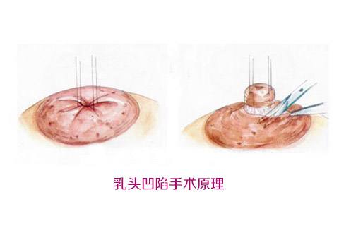 揭秘北京大學(xué)深圳醫(yī)院整形外科名醫(yī)團隊！想了解吸脂案例嗎？來看這里！