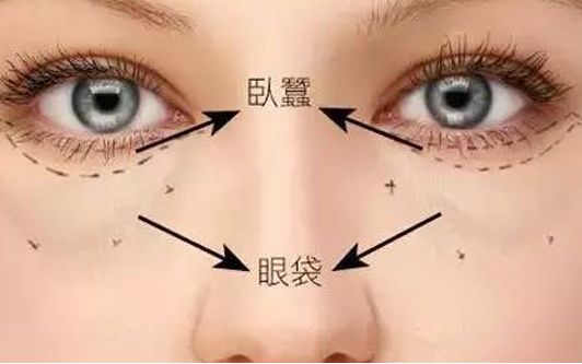 ?？谀募裔t(yī)院做眼袋效果好？