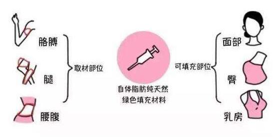 成都潘紅偉吸脂手術(shù)效果如何？專家解讀！