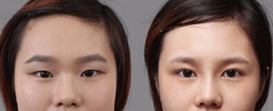 合肥哪家處女膜修復(fù)醫(yī)院靠譜又專業(yè)？