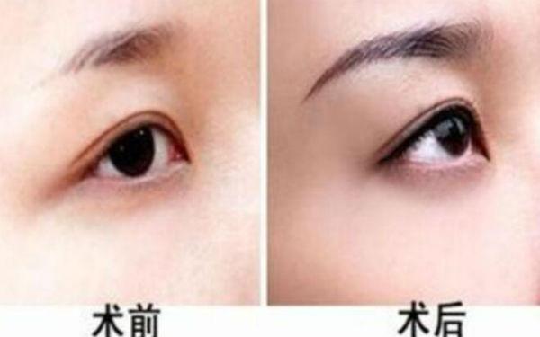 西京醫(yī)院超贊整形醫(yī)生與驚人隆鼻案例，受歡迎至極！