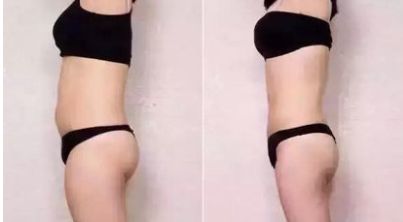 石家莊整容整形醫(yī)院哪家好？全面評測幫您選擇最佳醫(yī)療機構(gòu)！