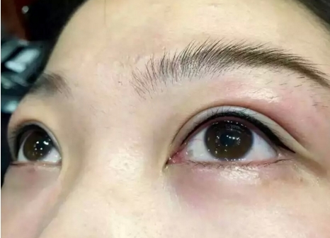 趙寅局院長去哪家醫(yī)院拉皮比較好？在上海天壇普華醫(yī)院坐診