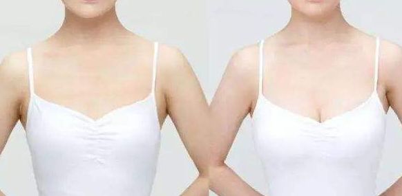 威海假體豐胸醫(yī)院哪家好？從專家口碑、手術(shù)效果看威海頂級醫(yī)院推薦！