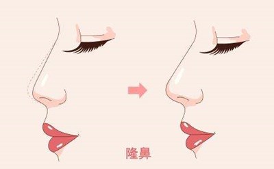 2023重慶膠原蛋白填充面部強(qiáng)榜前10名的專家(陳鵬、楊藝、蔣思軍這幾家技術(shù)高超價(jià)格低)