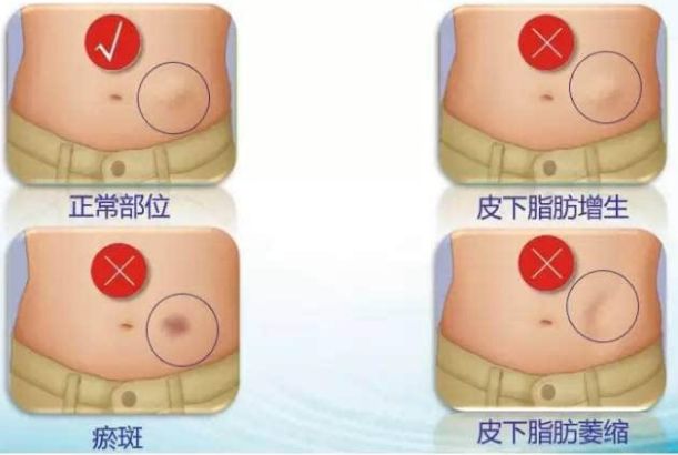 哈爾濱整形醫(yī)院哪家好？選擇哈爾濱整容醫(yī)院前必知的五大關鍵點