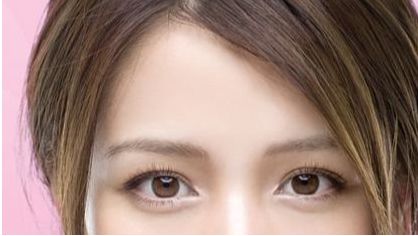 無錫哪家醫(yī)院隆鼻拆線技術(shù)好？專家為您推薦最佳選擇。