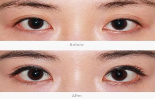 柳州哪家醫(yī)院做疤痕切除好？-獨家分享柳州疤痕切除醫(yī)院排行榜