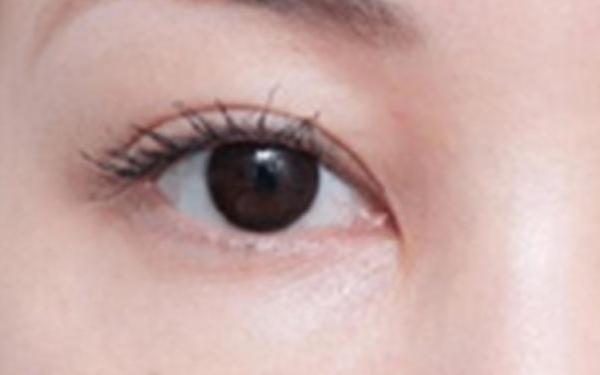 廣州哪家醫(yī)院做隆胸手術(shù)技術(shù)高？醫(yī)生資深經(jīng)驗來看詳細(xì)介紹！