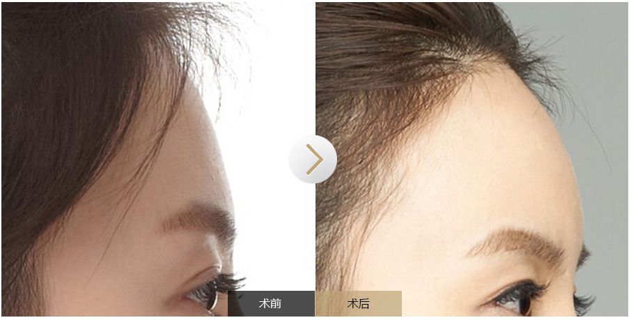 南寧點(diǎn)痣需求旺盛，哪家醫(yī)院是最受歡迎的？