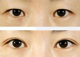 上海治療青春痘的專家推薦，哪家醫(yī)院效果最佳？