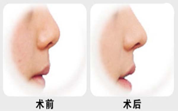 上海專業(yè)唇部整形五大口碑專家公布，人氣名醫(yī)張余光、周佳、戴傳昌等榜上有名