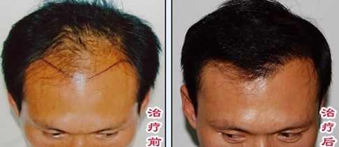 榆林醫(yī)專附屬醫(yī)院醫(yī)學(xué)整形美容中心怎么樣？榆林醫(yī)專附屬醫(yī)院醫(yī)學(xué)整形美容中心簡介|醫(yī)生團(tuán)隊|口碑評價！