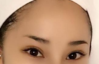 合肥哪家醫(yī)院臉部激光治療效果好，值得推薦？