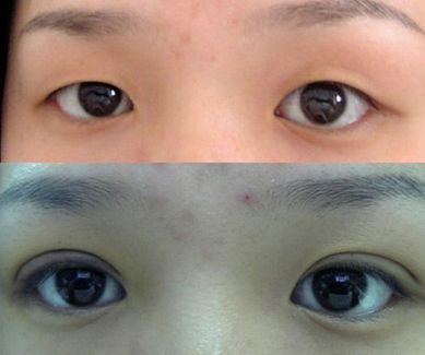 濟南哪家整形醫(yī)院的拉皮效果好且價格合適？