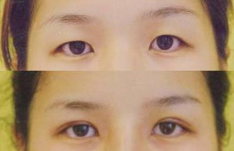大慶微整形醫(yī)院哪家好？頂級專家為您解讀微整形醫(yī)院選擇指南！