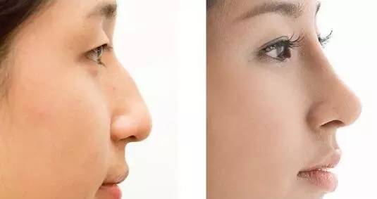 2023深圳瘦大腿吸脂術(shù)醫(yī)生榜單top10強(qiáng)(羅雄鵬、江虹、何安平這些醫(yī)生值得推薦)