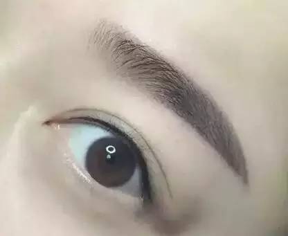 佰華利董萍的面部脂肪填充經(jīng)驗(yàn)，展現(xiàn)自然少女感