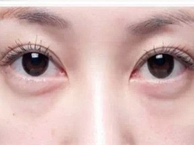 寧波祛斑哪家醫(yī)院好？精選寧波祛斑專業(yè)醫(yī)院推薦！